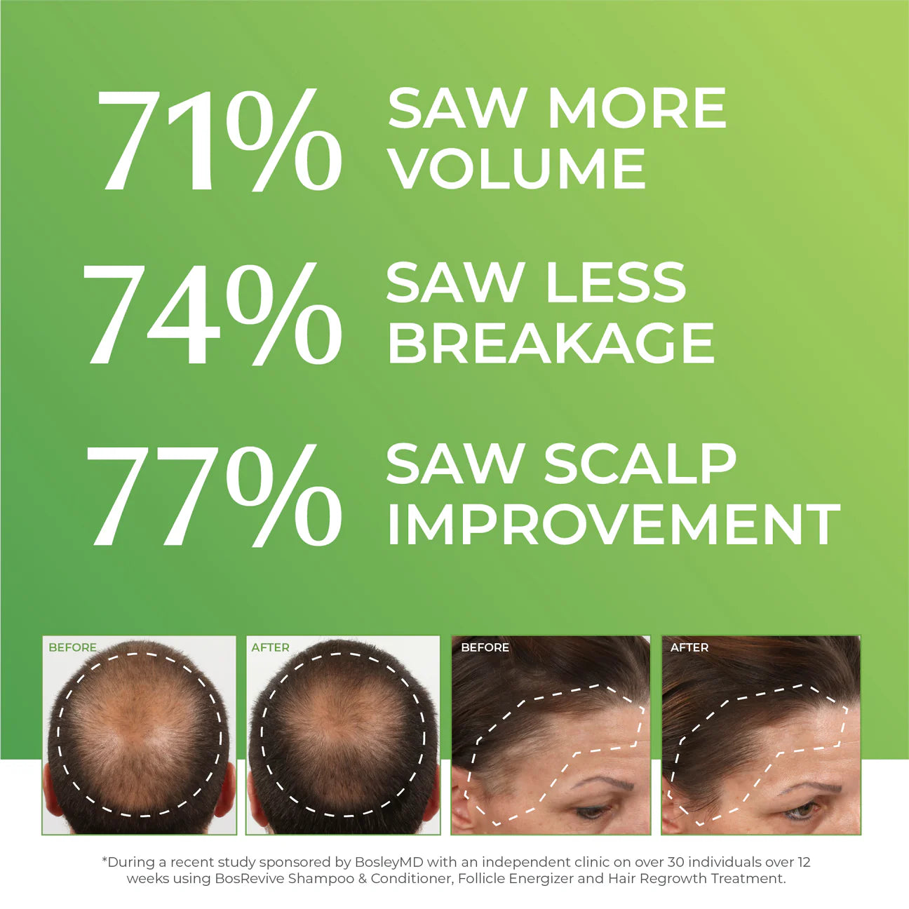 Healthy Hair & Scalp Follicle EnergizerHair CareBosleyMD EUBosleyMD Europe815266012724Healthy Hair & Scalp Follicle Energizer